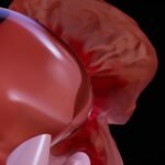 découvrez tout ce qu'il faut savoir sur la vésicule biliaire : son rôle, les maladies courantes, les symptômes associés et les options de traitement. informez-vous sur la santé de votre vésicule biliaire et les meilleures pratiques pour la maintenir en bon état.
